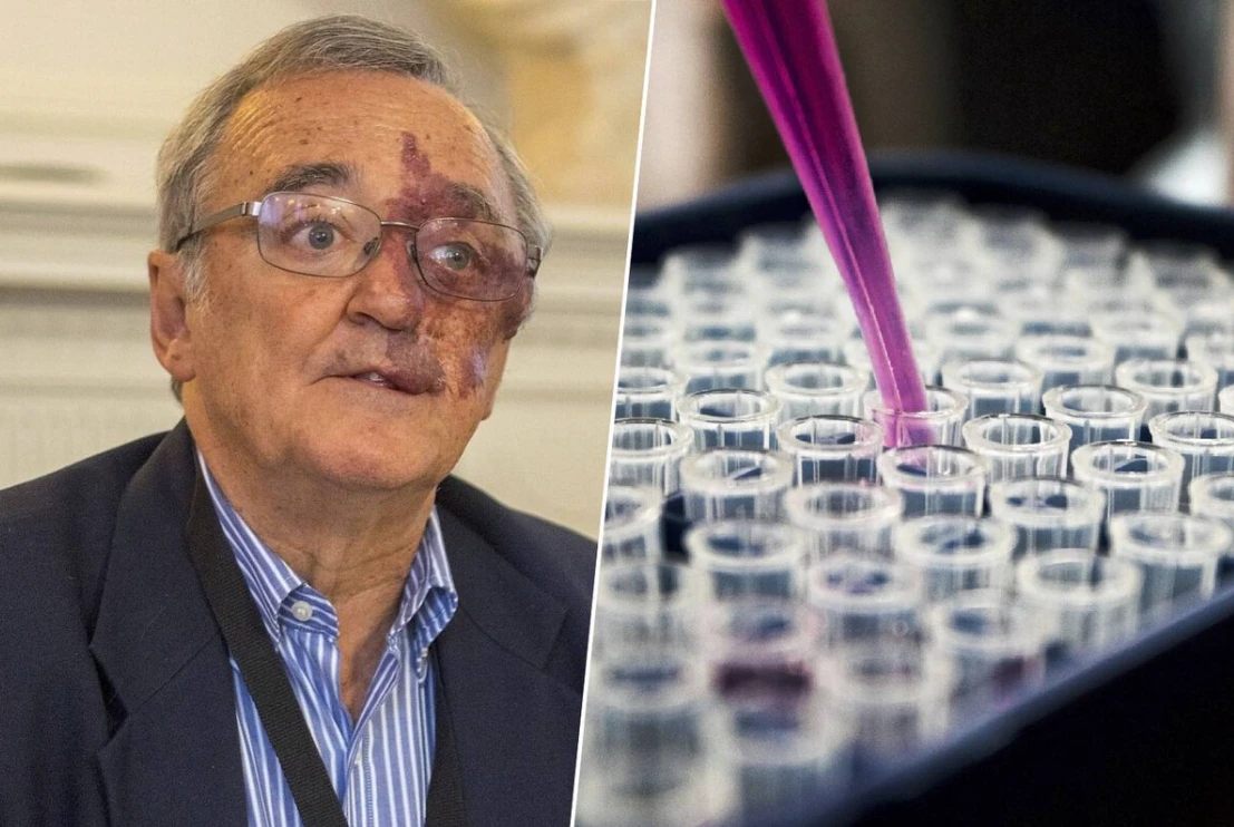 Científicos logran eliminar tumores de cáncer de páncreas en animales con tres fármacos